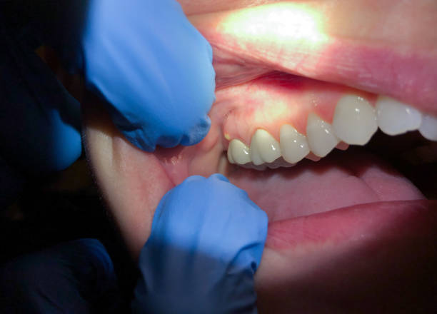 Best Tooth Infection Emergency Dentist  in Oxford, AL